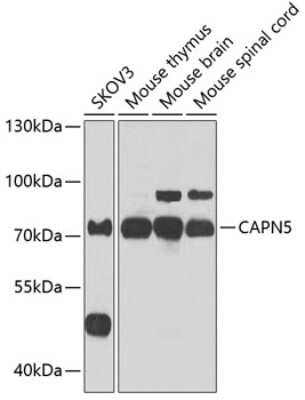 Western Blot: Calpain 5 Antibody [NBP2-92674] - Analysis of extracts of various cell lines, using Calpain 5 .Exposure time: 30s.