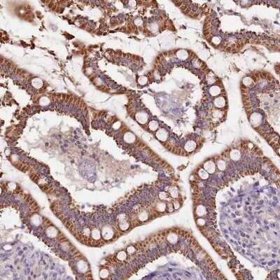 Immunohistochemistry-Paraffin: Calpain 7 Antibody [NBP2-14436] - Staining of human small intestine shows strong cytoplasmic positivity in glandular cells.