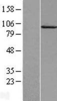 Western Blot: Calpain 7 Overexpression Lysate (Adult Normal) [NBL1-08683] Left-Empty vector transfected control cell lysate (HEK293 cell lysate); Right -Over-expression Lysate for Calpain 7.