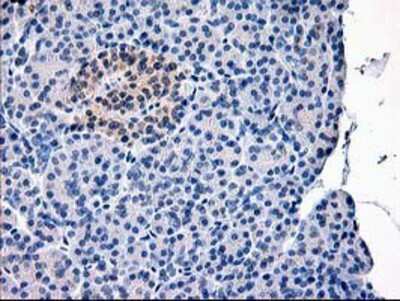 Immunohistochemistry-Paraffin: Calpain 9 Antibody (3G10) [NBP2-01305] - Staining of paraffin-embedded Human pancreas tissue using anti-Calpain 9 mouse monoclonal antibody.