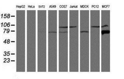 Western Blot: Calpain 9 Antibody (OTI3G10) - Azide and BSA Free [NBP2-71626] - Analysis of extracts (35ug) from 9 different cell lines by using anti-Calpain 9 monoclonal antibody.