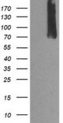 Western Blot: Calpain 9 Antibody (OTI3G10) - Azide and BSA Free [NBP2-71626] - HEK293T cells were transfected with the pCMV6-ENTRY control (Left lane) or pCMV6-ENTRY Calpain 9 (Right lane) cDNA for 48 hrs and lysed. Equivalent amounts of cell lysates (5 ug per lane) were separated by SDS-PAGE and immunoblotted with anti-Calpain 9.