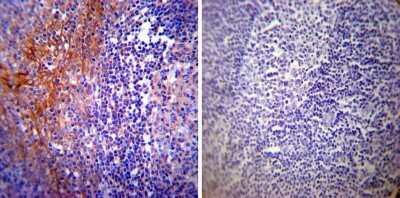Immunohistochemistry-Paraffin: Calpastatin Antibody (1F7E3D10) [NB120-5582] - Both normal and cancer biopsies of deparaffinized Human tonsil tissues.