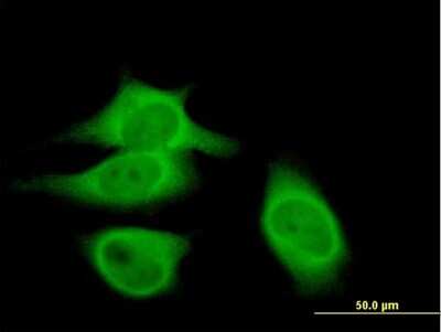 Immunocytochemistry/Immunofluorescence: Calpastatin Antibody [H00000831-B01P] - Analysis of purified antibody to CAST on HeLa cell. (antibody concentration 10 ug/ml)