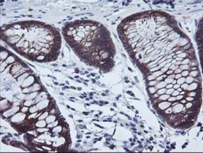 Immunohistochemistry: Calpastatin Antibody (OTI1E7) - Azide and BSA Free [NBP2-70338] - Staining of paraffin-embedded Human colon tissue using anti-Calpastatin mouse monoclonal antibody.