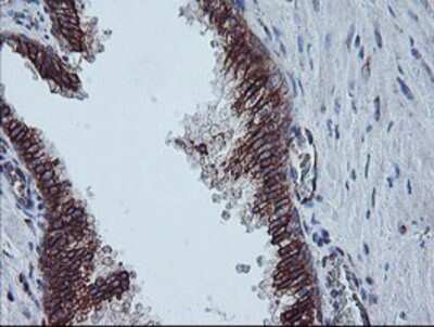 Immunohistochemistry: Calpastatin Antibody (OTI1E7) - Azide and BSA Free [NBP2-70338] - Staining of paraffin-embedded Human prostate tissue using anti-Calpastatin mouse monoclonal antibody.