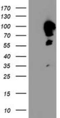 Western Blot Calpastatin Antibody (OTI1E7) - Azide and BSA Free