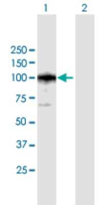Western Blot: Calpastatin Antibody [H00000831-B01P] - Analysis of CAST expression in transfected 293T cell line by CAST polyclonal antibody.  Lane 1: CAST transfected lysate(73.37 KDa). Lane 2: Non-transfected lysate.