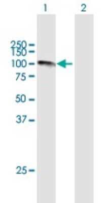 Western Blot: Calpastatin Antibody [H00000831-B02P] - Analysis of CAST expression in transfected 293T cell line by CAST polyclonal antibody.  Lane 1: CAST transfected lysate(75.46 KDa). Lane 2: Non-transfected lysate.