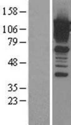 Western Blot Calpastatin Overexpression Lysate