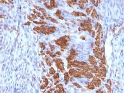 Immunohistochemistry-Paraffin: Calponin 1 Antibody (CNN1/832 + CALP) - Azide and BSA Free [NBP2-47758] - Human Uterus stained with Calponin-1 Monoclonal Antibody (CNN1/832 + CALP).