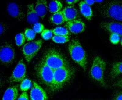 Immunocytochemistry/Immunofluorescence: Calponin 1 Antibody (SI67-01) [NBP2-67401] - Staining Calponin in HepG2 cells (green). The nuclear counter stain is DAPI (blue). Cells were fixed in paraformaldehyde, permeabilised with 0.25% Triton X100/PBS.