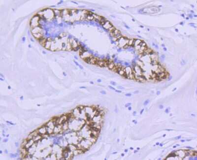 Immunohistochemistry-Paraffin: Calponin 1 Antibody (SI67-01) [NBP2-67401] - Analysis of paraffin-embedded human breast tissue using anti-Calponin antibody. Counter stained with hematoxylin.