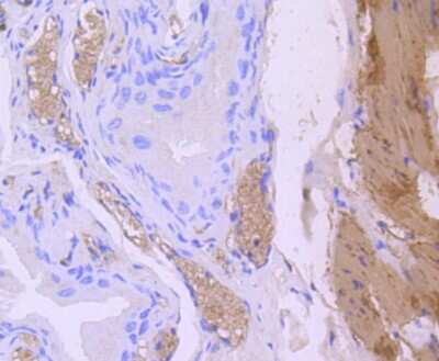 Immunohistochemistry-Paraffin: Calponin 1 Antibody (SI67-01) [NBP2-67401] - Analysis of paraffin-embedded mouse bladder tissue using anti-Calponin antibody. Counter stained with hematoxylin.