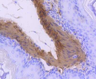 Immunohistochemistry-Paraffin: Calponin 1 Antibody (SI67-01) [NBP2-67401] - Analysis of paraffin-embedded mouse stomach tissue using anti-Calponin antibody. Counter stained with hematoxylin.