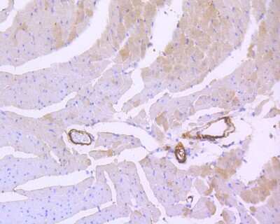 Immunohistochemistry-Paraffin: Calponin 1 Antibody (SI67-01) [NBP2-67401] - Immunohistochemical analysis of paraffin-embedded mouse heart tissue using anti-Calponin 1 antibody. The section was pre-treated using heat mediated antigen retrieval with Tris-EDTA buffer (pH 8.0-8.4) for 20 minutes. The tissues were blocked in 5% BSA for 30 minutes at room temperature, washed with ddH2O and PBS, and then probed with the primary antibody (ET1606-17, 1/50) for 30 minutes at room temperature. The detection was performed using an HRP conjugated compact polymer system. DAB was used as the chromogen. Tissues were counterstained with hematoxylin and mounted with DPX.