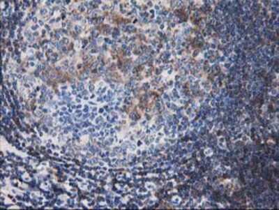 Immunohistochemistry-Paraffin: Calponin 2 Antibody (2B5) [NBP2-01325] - Staining of paraffin-embedded Human tonsil using anti-Calponin 2 mouse monoclonal antibody.