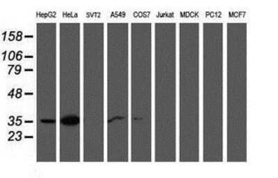 Western Blot: Calponin 2 Antibody (2B5) [NBP2-01325] Analysis of extracts (35ug) from 9 different cell lines by using anti-Calponin 2 monoclonal antibody.