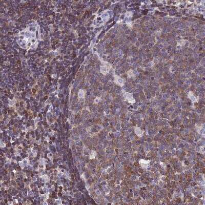 Immunohistochemistry-Paraffin: Calponin 2 Antibody [NBP2-13848] - Staining of human lymph node shows moderate cytoplasmic positivity in germinal and non-germinal center cells.