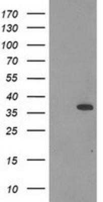 Western Blot: Calponin 2 Antibody (OTI2B5) - Azide and BSA Free [NBP2-70421] - HEK293T cells were transfected with the pCMV6-ENTRY control (Left lane) or pCMV6-ENTRY Calponin 2 (Right lane) cDNA for 48 hrs and lysed. Equivalent amounts of cell lysates (5 ug per lane) were separated by SDS-PAGE and immunoblotted with anti-Calponin 2.