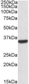 Western Blot: Calponin 2 Antibody [NBP1-36741] - Analysis of Calponin 2 in HepG2 lysates (35ug protein in RIPA buffer) with (B) and without (A) blocking with the immunizing peptide using this antibody at 0.03 ug/ml. Primary incubation was 1 hour. Detected by chemiluminescence.