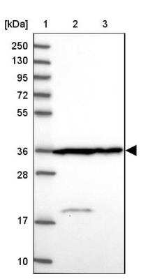 Western Blot: Calponin 2 Antibody [NBP2-13848] - Lane 1: Marker  [kDa] 250, 130, 95, 72, 55, 36, 28, 17, 10.  Lane 2: Human cell line RT-4.  Lane 3: Human cell line U-251MG sp