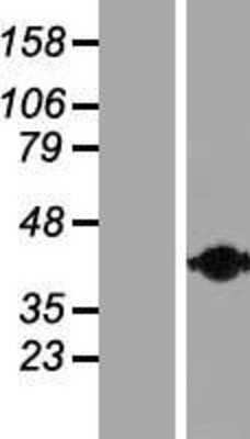 Western Blot: Calponin 2 Overexpression Lysate (Adult Normal) [NBP2-10589] Left-Empty vector transfected control cell lysate (HEK293 cell lysate); Right -Over-expression Lysate for Calponin 2.
