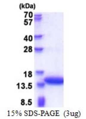 SDS-Page: Calponin 2 Recombinant Protein [NBP2-51593] - 15% SDS Page (3 ug)