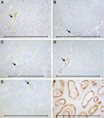 Immunohistochemistry Calreticulin-2/CALR3 Antibody - BSA Free