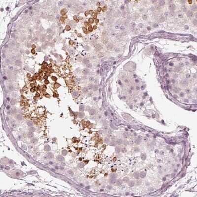 Immunohistochemistry-Paraffin Calreticulin-2/CALR3 Antibody - BSA Free