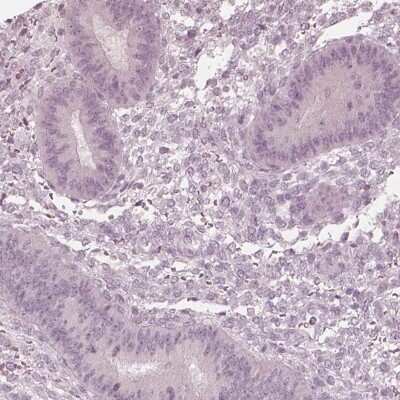 Immunohistochemistry-Paraffin Calreticulin-2/CALR3 Antibody - BSA Free