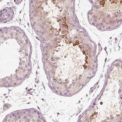 Immunohistochemistry-Paraffin Calreticulin-2/CALR3 Antibody - BSA Free