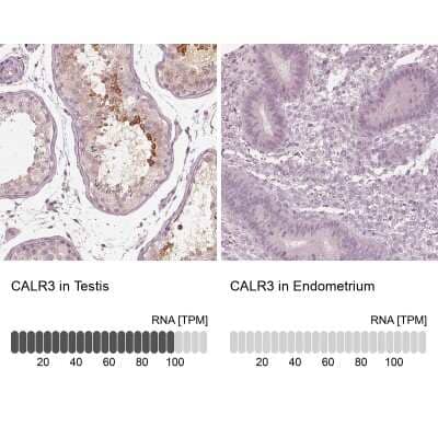 Immunohistochemistry-Paraffin Calreticulin-2/CALR3 Antibody - BSA Free