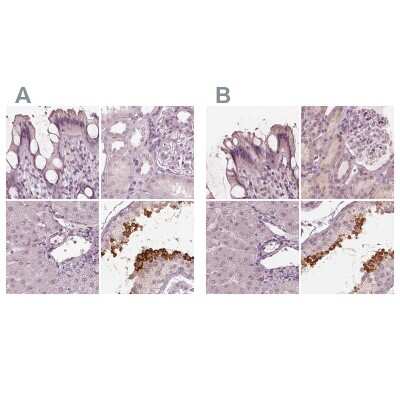 Immunohistochemistry-Paraffin Calreticulin-2/CALR3 Antibody - BSA Free