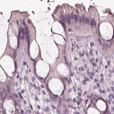 Immunohistochemistry-Paraffin Calreticulin-2/CALR3 Antibody - BSA Free