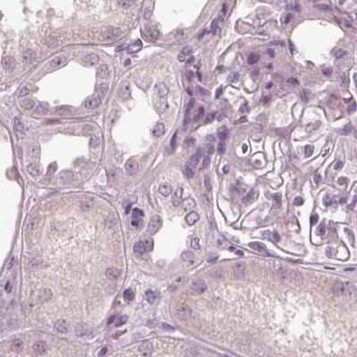 Immunohistochemistry-Paraffin Calreticulin-2/CALR3 Antibody - BSA Free