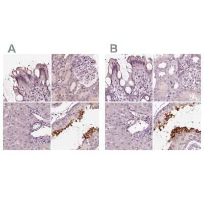 Immunohistochemistry-Paraffin: Calreticulin-2/CALR3 Antibody [NBP2-33524] - Staining of human colon, kidney, liver and testis using Anti-CALR3 antibody NBP2-33524 (A) shows similar protein distribution across tissues to independent antibody NBP2-33390 (B).