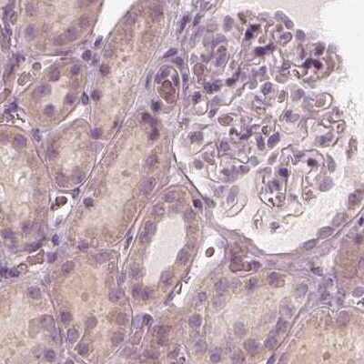 Immunohistochemistry-Paraffin: Calreticulin-2/CALR3 Antibody [NBP2-33524] - Staining of human kidney.