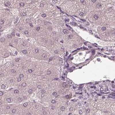 Immunohistochemistry-Paraffin: Calreticulin-2/CALR3 Antibody [NBP2-33524] - Staining of human liver.