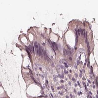 Immunohistochemistry-Paraffin: Calreticulin-2/CALR3 Antibody [NBP2-33524] - Staining of human colon.
