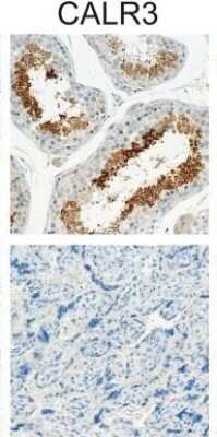 Immunohistochemistry-Paraffin: Calreticulin-2/CALR3 Antibody [NBP2-33524] - Immunohistochemical staining of CT antigens in normal tissues. Among 22 normal tissues (see materials and methods), ADAM2, CALR3 (shown in image), SAGE1 and MAGE-A proteins were only detected in the germ cells of the testis. More specifically, SAGE-1 and MAGE-A were found in spermatogonia, while ADAM2 and CALR3 were present in post-meiotic germ cells. Only MAGE-A proteins were detected in placenta (all pictures magnification x20). Image collected and cropped by CiteAb from the following publication (//dx.plos.org/10.1371/journal.pone.0134967), licensed under a CC-BY license.