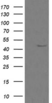 Western Blot: Calreticulin-2/CALR3 Antibody (OTI1E1) - Azide and BSA Free [NBP2-72380] - Analysis of HEK293T cells were transfected with the pCMV6-ENTRY control (Left lane) or pCMV6-ENTRY CALR3.