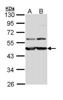 Western Blot: Calreticulin-2/CALR3 Antibody [NBP1-33337] - Sample (30 ug of whole cell lysate) A: Molt-4 B: Raji 10% SDS PAGE; antibody diluted at 1:1000.