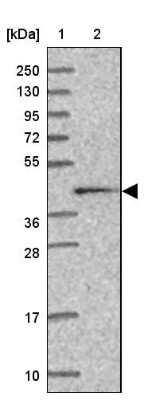 Western Blot: Calreticulin-2/CALR3 Antibody [NBP2-33524] - Lane 1: Marker  [kDa] 250, 130, 95, 72, 55, 36, 28, 17, 10.  Lane 2: Human cell line RT-4