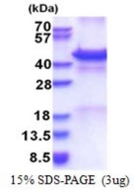 SDS-PAGE Recombinant Human Calreticulin-2/CALR3 Protein