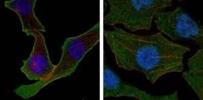 Immunocytochemistry/Immunofluorescence: Calreticulin Antibody (1G6A7) - Azide and BSA Free [NBP2-80610] - Analysis of SKBR-3 (left) and A549 (right) cells using anti-Calreticulin mAb (green). Actin filaments have been labeled with DY-554 phalloidin (red). DRAQ5 fluorescent DNA dye (blue). Image from the standard format of this antibody.