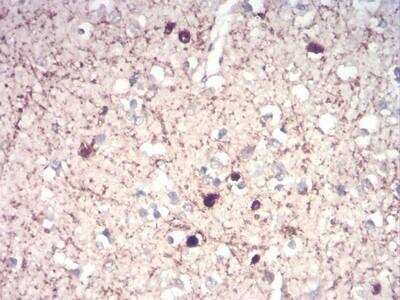 Immunohistochemistry-Paraffin: Calretinin Antibody (1F5H1) [NBP2-52426] - Immunohistochemical analysis of paraffin-embedded brain tissues using CALB2 mouse mAb with DAB staining.
