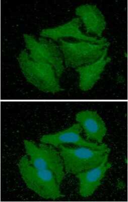 Immunocytochemistry/Immunofluorescence: Calretinin Antibody (5C5) [NBP2-59473] - Analysis of CALB2 in HeLa cells line, stained with DAPI (Blue) for nucleus staining and monoclonal anti-human   CALB2 antibody (1:100) with goat anti-mouse IgG-Alexa fluor 488 conjugate (Green).