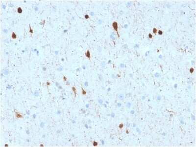 Immunohistochemistry-Paraffin: Calretinin Antibody (CALB2/2602) [NBP3-08323] - Formalin-fixed, paraffin-embedded human Cerebellum stained with Calretinin Mouse Monoclonal Antibody (CALB2/2602).
