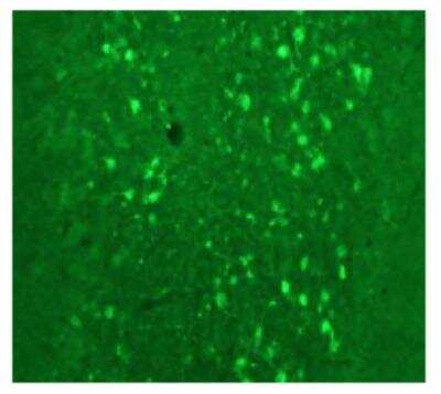 Immunohistochemistry: Calretinin Antibody [NBP1-30050] - Immunostaining of rat cerebellum showing fluorescence of calretinin containing cells.